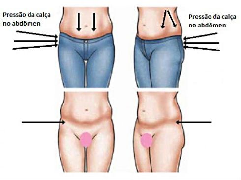 calca+jeans+deforma+corpo+mulher